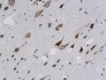 Calponin 1 Antibody in Immunohistochemistry (Paraffin) (IHC (P))