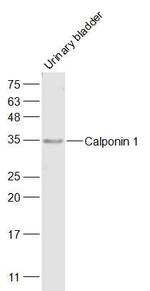 Calponin 1 Antibody in Western Blot (WB)