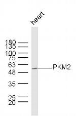 PKM2 Antibody in Western Blot (WB)