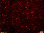 PKM2 Antibody in Immunohistochemistry (Paraffin) (IHC (P))