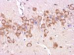 beta Amyloid 1-42 Antibody in Immunohistochemistry (Paraffin) (IHC (P))