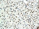 Estrogen receptor beta Antibody in Immunohistochemistry (Paraffin) (IHC (P))