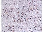 SYAP1 Antibody in Immunohistochemistry (Paraffin) (IHC (P))