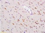 HSP70 Antibody in Immunohistochemistry (Paraffin) (IHC (P))