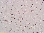 Bax Antibody in Immunohistochemistry (Paraffin) (IHC (P))