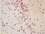 Tau protein Antibody in Immunohistochemistry (Paraffin) (IHC (P))