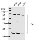 Tau protein Antibody in Western Blot (WB)
