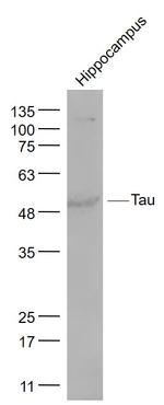 Tau protein Antibody in Western Blot (WB)