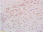 Tubulin-alpha Antibody in Immunohistochemistry (Paraffin) (IHC (P))