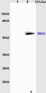 Tubulin-alpha Antibody in Western Blot (WB)