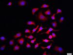 p75 NGF Receptor Antibody in Immunocytochemistry (ICC/IF)