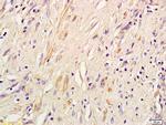 IRS-3 Antibody in Immunohistochemistry (Paraffin) (IHC (P))