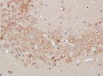 TrkA Antibody in Immunohistochemistry (Paraffin) (IHC (P))