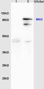 GRP94 Antibody in Immunohistochemistry (Paraffin) (IHC (P))