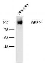 GRP94 Antibody in Western Blot (WB)