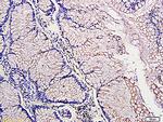 PDGF A Antibody in Immunohistochemistry (Paraffin) (IHC (P))