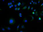 GFAP Antibody in Immunocytochemistry (ICC/IF)