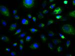 GFAP Antibody in Immunocytochemistry (ICC/IF)