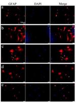 GFAP Antibody in Immunocytochemistry (ICC/IF)
