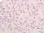 Tubulin-beta Antibody in Immunohistochemistry (Paraffin) (IHC (P))