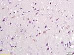 NMDAR2B Antibody in Immunohistochemistry (Paraffin) (IHC (P))