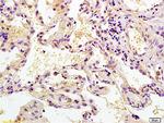 MEK2 Antibody in Immunohistochemistry (Paraffin) (IHC (P))