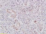 IGF1R Antibody in Immunohistochemistry (Paraffin) (IHC (P))