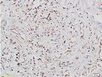 IGF1R Antibody in Immunohistochemistry (Paraffin) (IHC (P))
