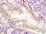 PDGFRA Antibody in Immunohistochemistry (Paraffin) (IHC (P))