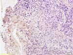 PDGF Receptor beta Antibody in Immunohistochemistry (Paraffin) (IHC (P))