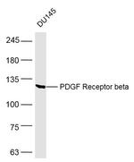 PDGF Receptor beta Antibody in Western Blot (WB)