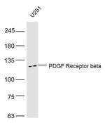 PDGF Receptor beta Antibody in Western Blot (WB)