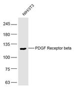 PDGF Receptor beta Antibody in Western Blot (WB)