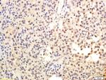 TERT Antibody in Immunohistochemistry (Paraffin) (IHC (P))