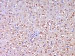 TERT Antibody in Immunohistochemistry (Paraffin) (IHC (P))