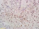 TERT Antibody in Immunohistochemistry (Paraffin) (IHC (P))