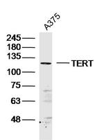 TERT Antibody in Western Blot (WB)