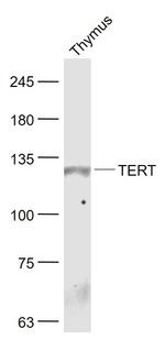 TERT Antibody in Western Blot (WB)