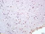 HSP70 1A/1B Antibody in Immunohistochemistry (Paraffin) (IHC (P))