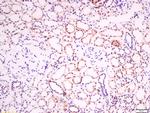 EphB2 R Antibody in Immunohistochemistry (Paraffin) (IHC (P))