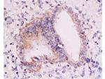 RAR alpha Antibody in Immunohistochemistry (Paraffin) (IHC (P))