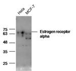 Estrogen receptor alpha Antibody in Western Blot (WB)