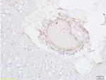 Estrogen receptor beta Antibody in Immunohistochemistry (Paraffin) (IHC (P))