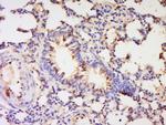 PBEF1 Antibody in Immunohistochemistry (Paraffin) (IHC (P))