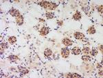 PBEF1 Antibody in Immunohistochemistry (Paraffin) (IHC (P))