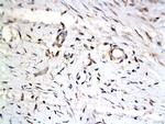 IASPP Antibody in Immunohistochemistry (Paraffin) (IHC (P))