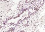 PADI4 Antibody in Immunohistochemistry (Paraffin) (IHC (P))