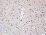Myelin Protein Zero Antibody in Immunohistochemistry (Paraffin) (IHC (P))