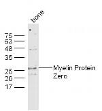 Myelin Protein Zero Antibody in Western Blot (WB)
