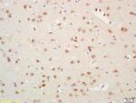 Histone H3 Antibody in Immunohistochemistry (Paraffin) (IHC (P))
